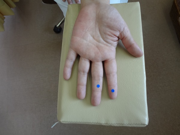 認知症に効果的なツボ刺激