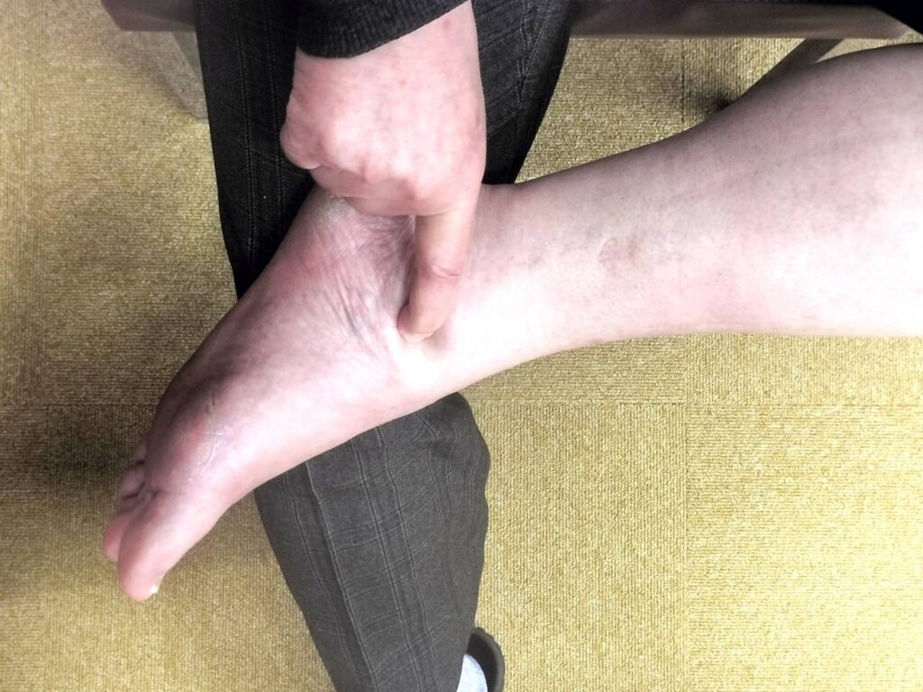 五十肩ポイント「肩の前面」